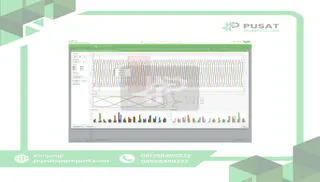 Schneider Electric PSWMANCZZSPEZZ Backup Power Module for Power Monitoring Expert software
